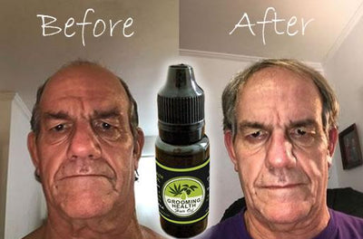 OUR BEARD & HAIR GROWTH OIL SHOWS INCREDIBLE REAL RESULTS ON HEAD HAIR